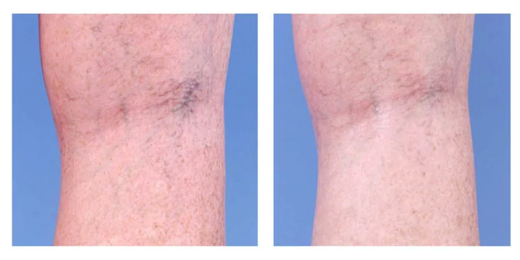 Αισθητική διόρθωση